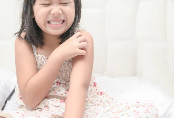 girl scratch the itch with hand , Concept with Healthcare And Medicine.